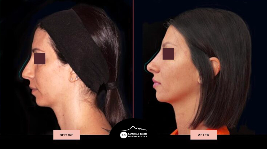 Raffaella Casilli - Medicina estetica